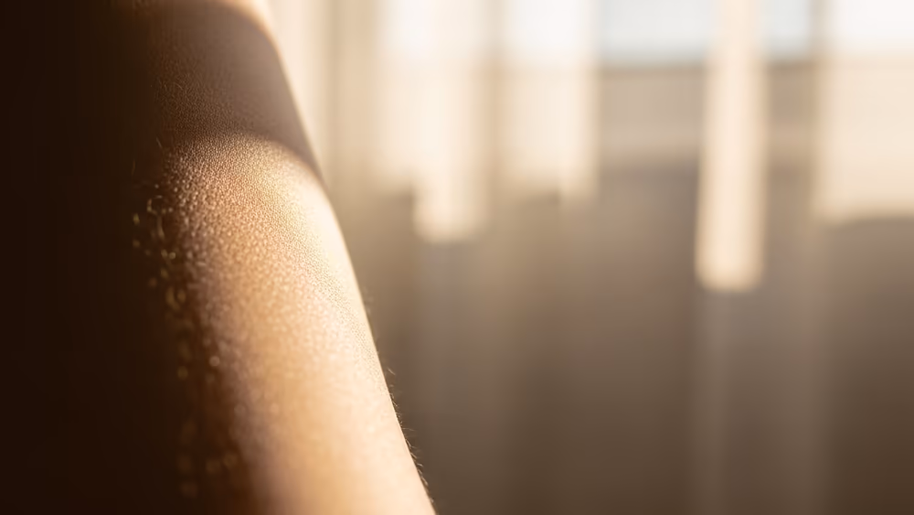 Teenager with skin cancer who sued over misdiagnosis settles action for €2m