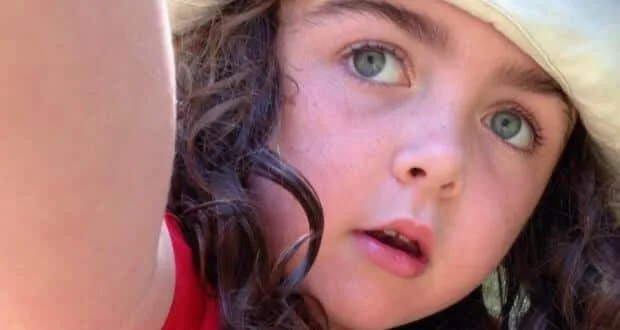 Girl who suffered brain damage due to water on the brain has secured an interim payment (As reported by Irish Independent June 2015)
